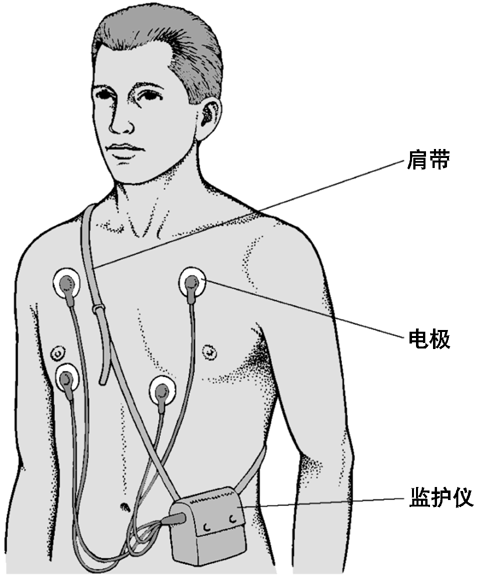 心脏疾病的诊断