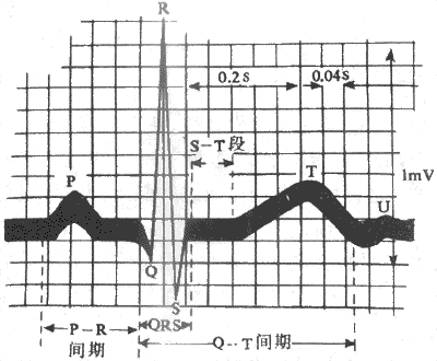 正常人心电模式图